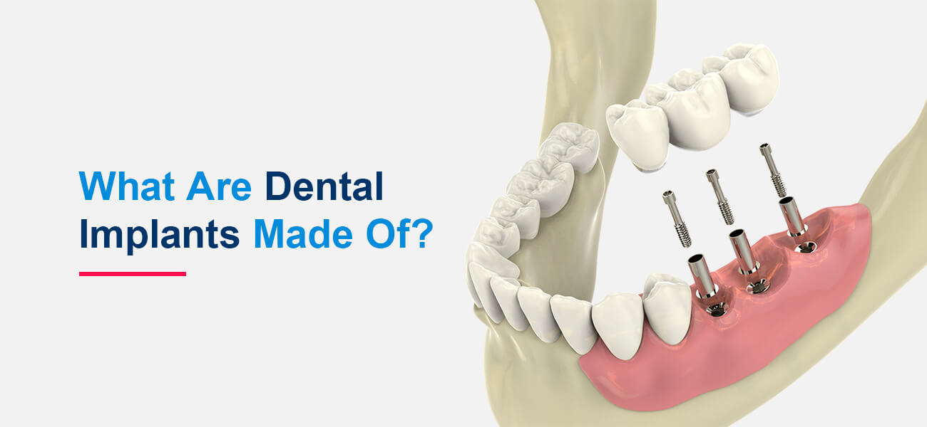 what are dental implants?